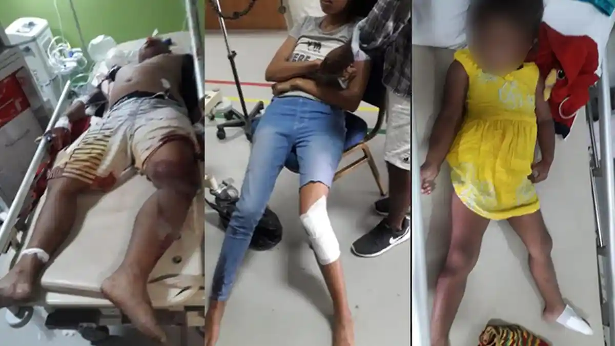 Satu Keluarga Alami Kecelakaan di Ungasan, Bapak Keluarga Tewas dengan Luka Parah