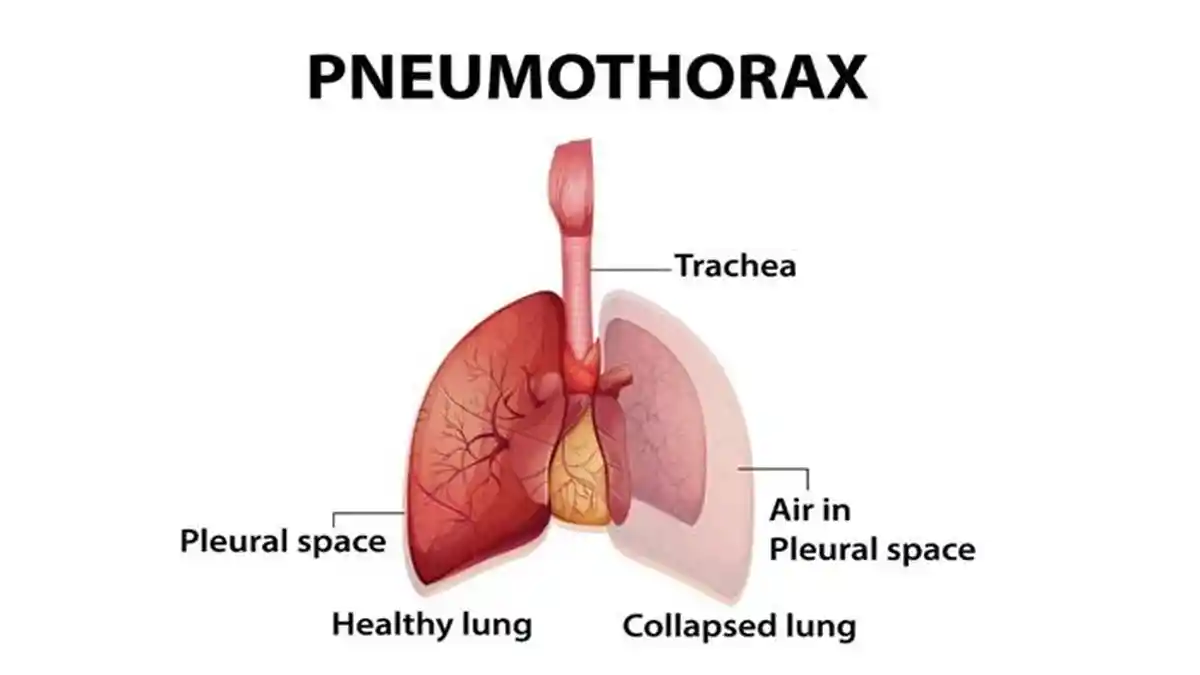 40 Latihan Soal Ujian Sumatif Akhir Tahun IPA Kelas 8 SMP/MTs, Soal Versi 2025 Beserta Kunci Jawaban