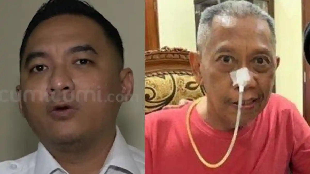 Kondisi Kesehatan Tukul Arwana Mulai Membaik Tapi Masih Dibantu Selang untuk Makan