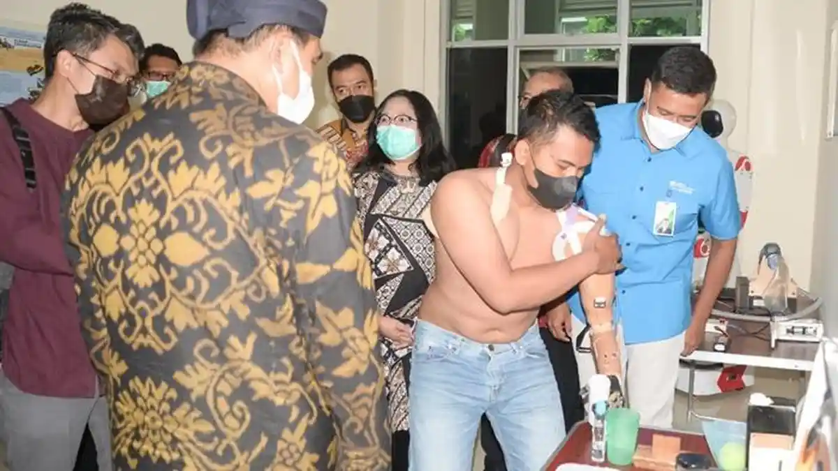 BPJS Ketenagakerjaan Jamin Pemasangan Protese Tangan Robotik Pekerja