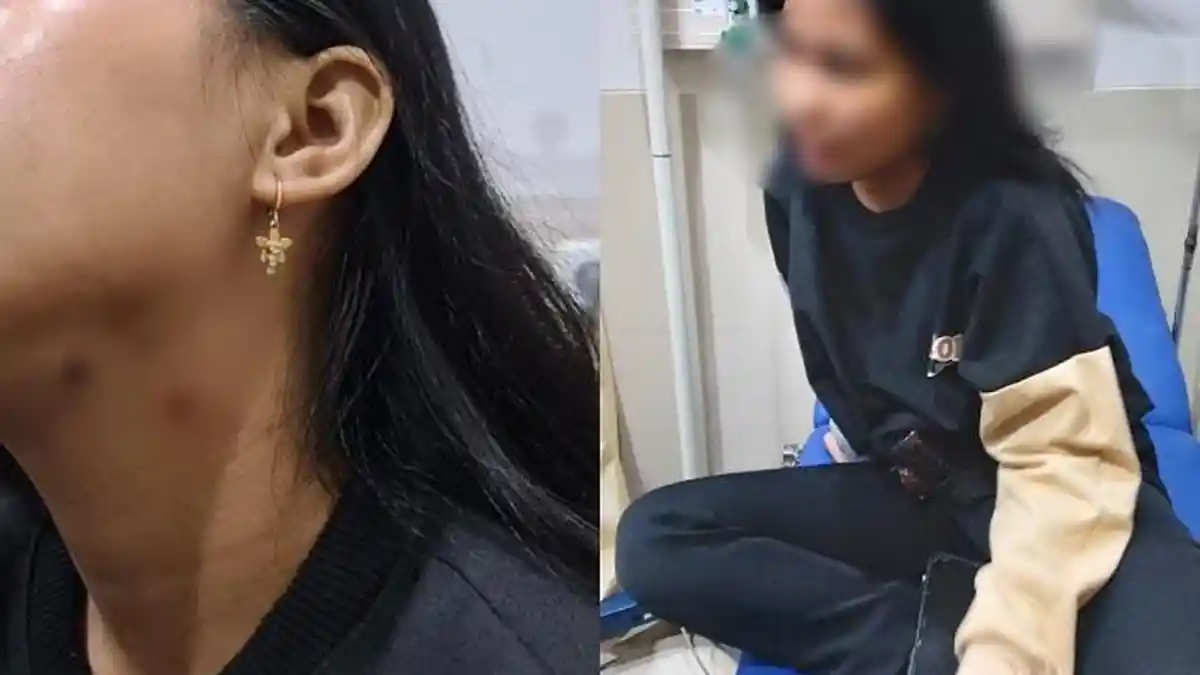 Teror Begal Kembali Terjadi di Makassar, Siswi SMA Kena Busur di Leher