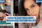 artis-anggita-sari-curhat-pengalaman-treatment-di-klinik-kecantikan-benang-keluar-dari-wajah.jpg