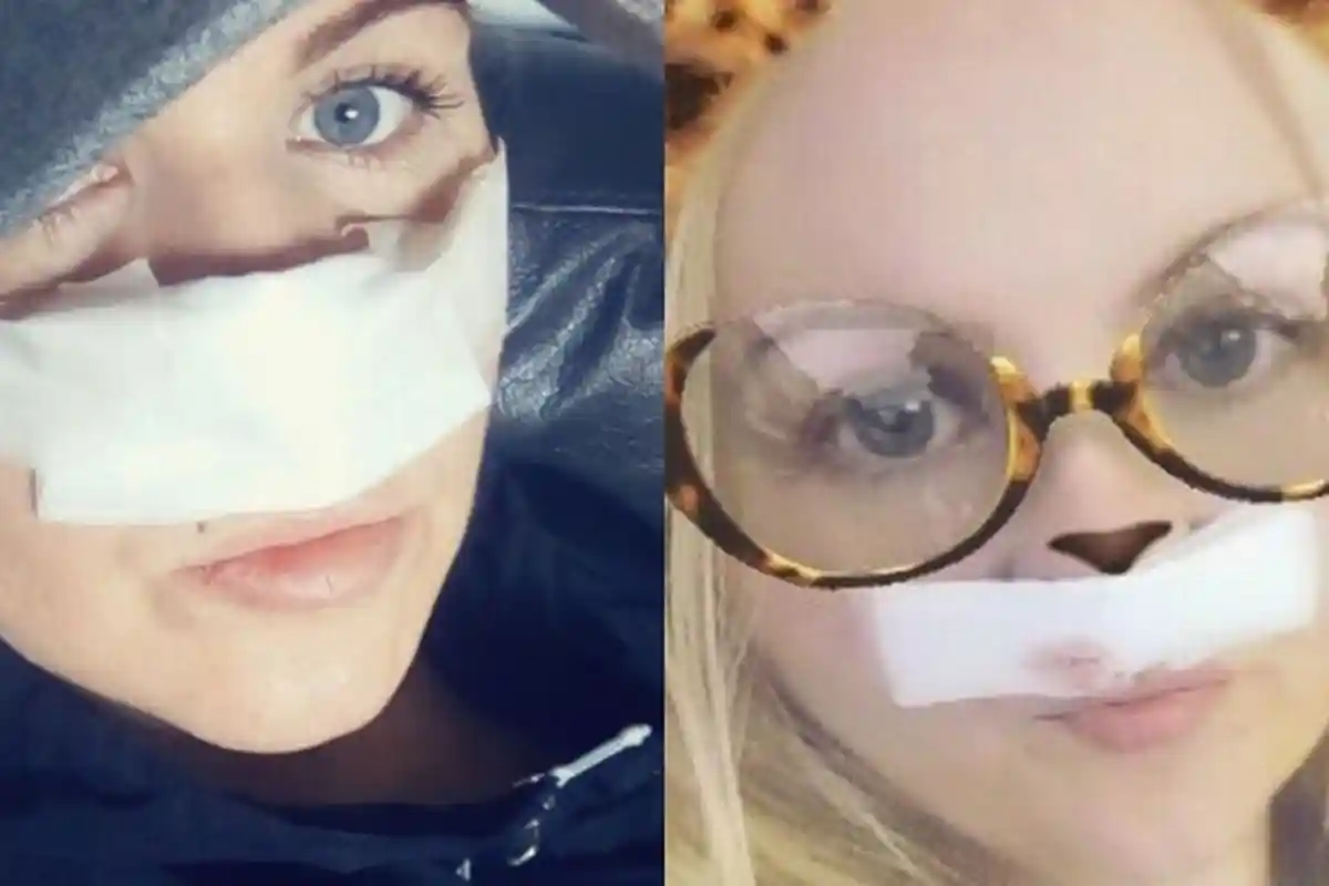 Hidungnya Jadi Begini setelah Operasi, Ibu Rumah Tangga Tak Berani Keluar Rumah Selama 2 Tahun