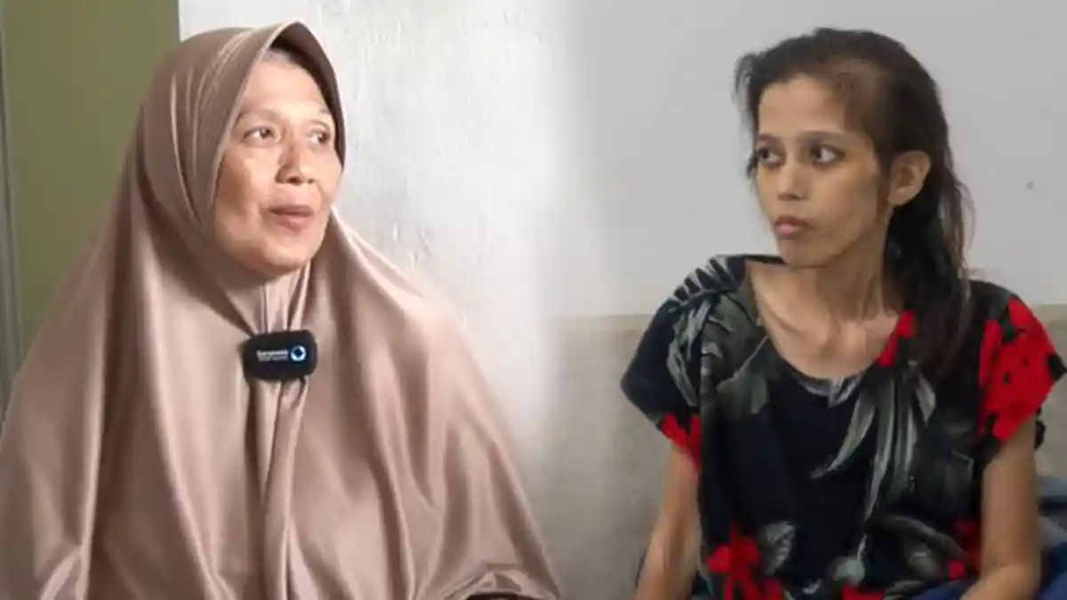 Kondisi Mantan TKI Taiwan Usai Bohongi Ibu, Dona Dilarikan ke RSCM, BPJS Ternyata Nunggak 3 Bulan