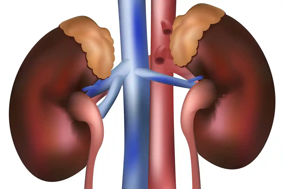 KISAH HARU Laondeng yang Rela Donorkan Ginjal untuk Putrinya yang Kritis dan Cuci Darah Seminggu 2 X