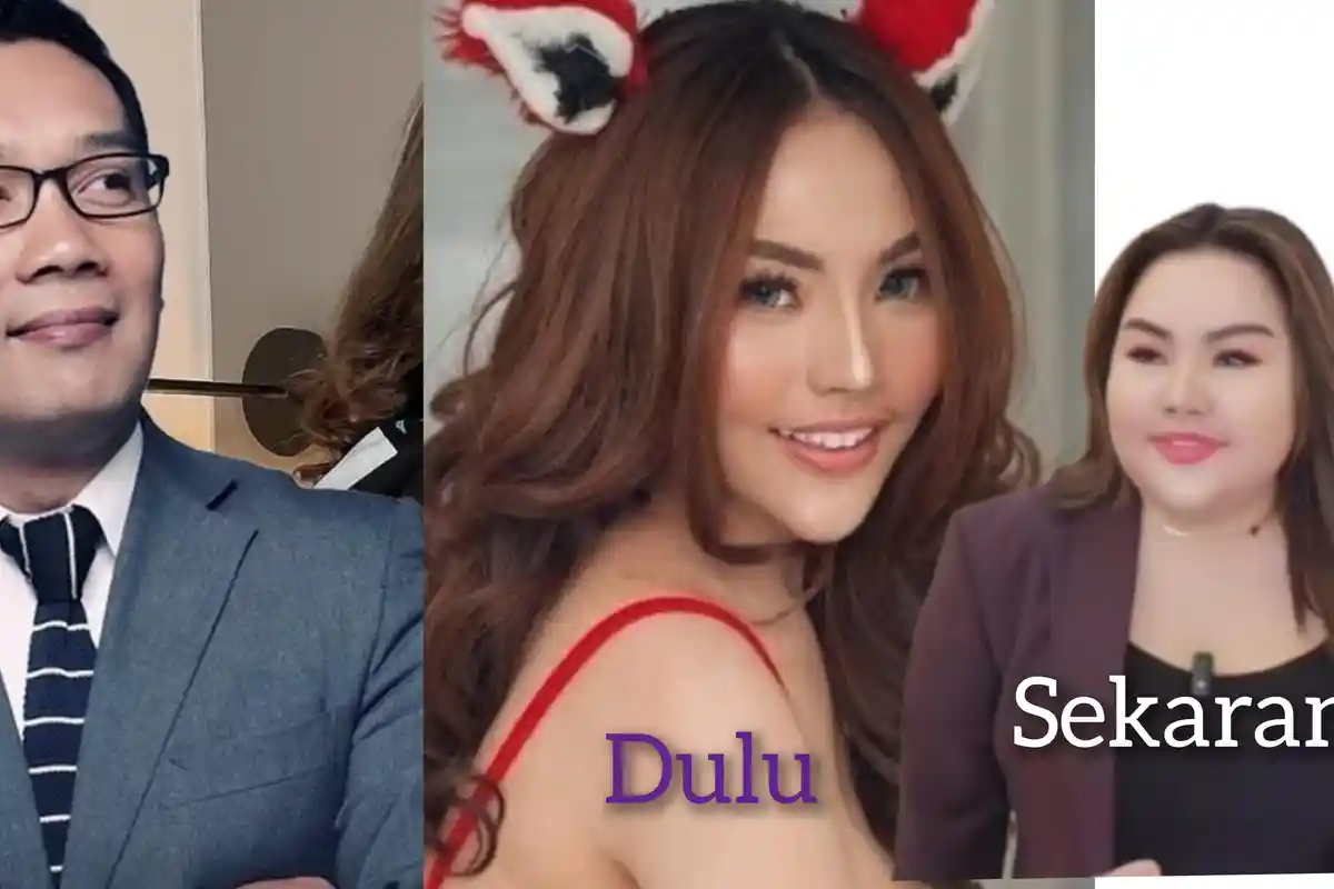 Lisa Mariana Akan Jalani Operasi Bariatrik Demi Langsing 48 Kg