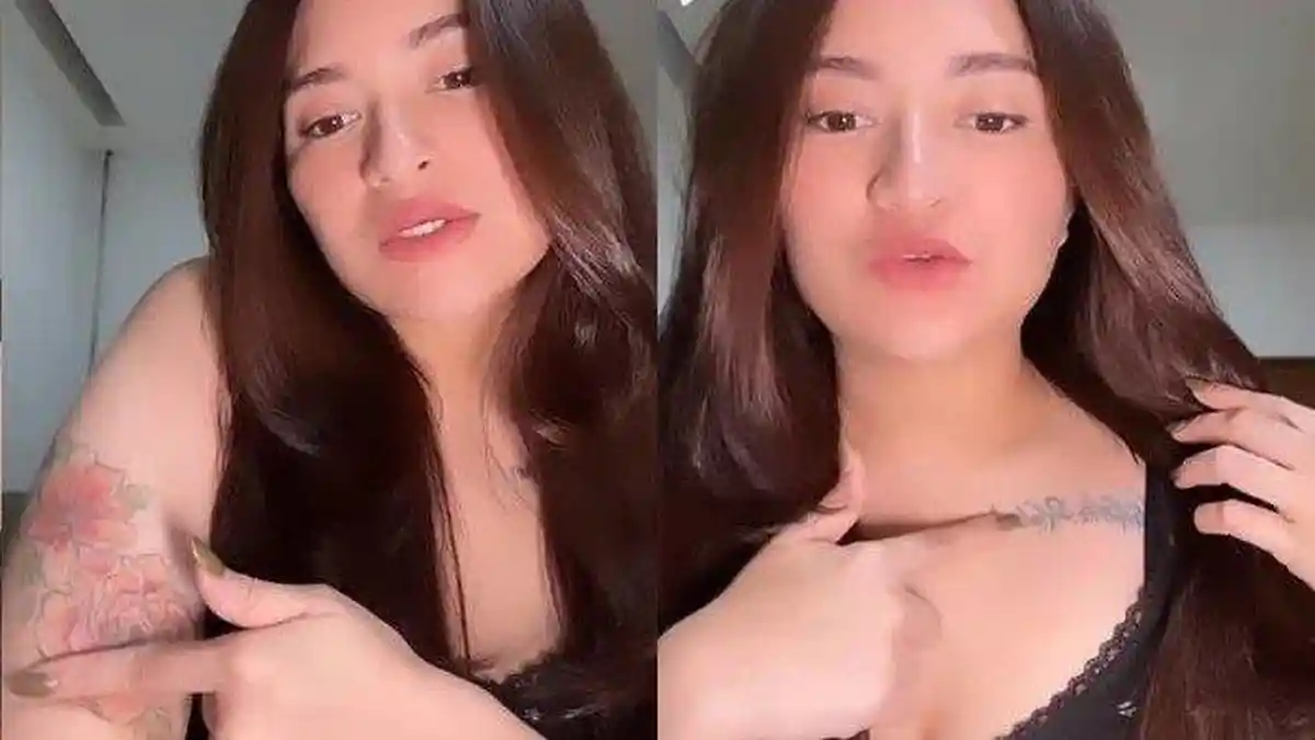 Mantan Istri Sule Kesakitan, Nathalie Holscher Hapus Tato di Dada: Sudah 7 Kali Laser Belum Hilang