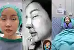 Potret-Lucinta-Luna-Ketika-Melakukan-Operasi-Hidung-Lagi.jpg