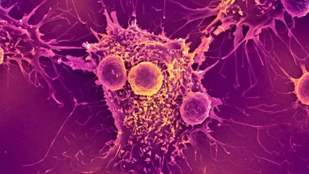 Terungkap! Vaksin COVID-19 Ternyata Bisa Bantu Lawan Kanker, Berikut Faktanya