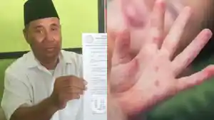 berita-madura-terpopuler-pada-rabu-8-april-2026-suspek-campak-sampang-ponpes-bangkalan.jpg