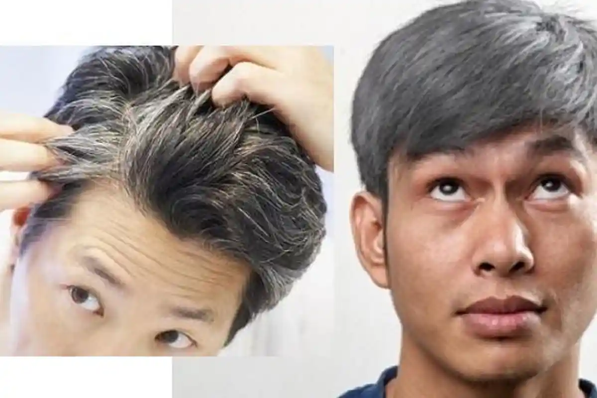 Uban Hilang dan Rambut Segera Hitam, Cukup Konsumsi Rempah Ini Kata dr Zaidul Akbar