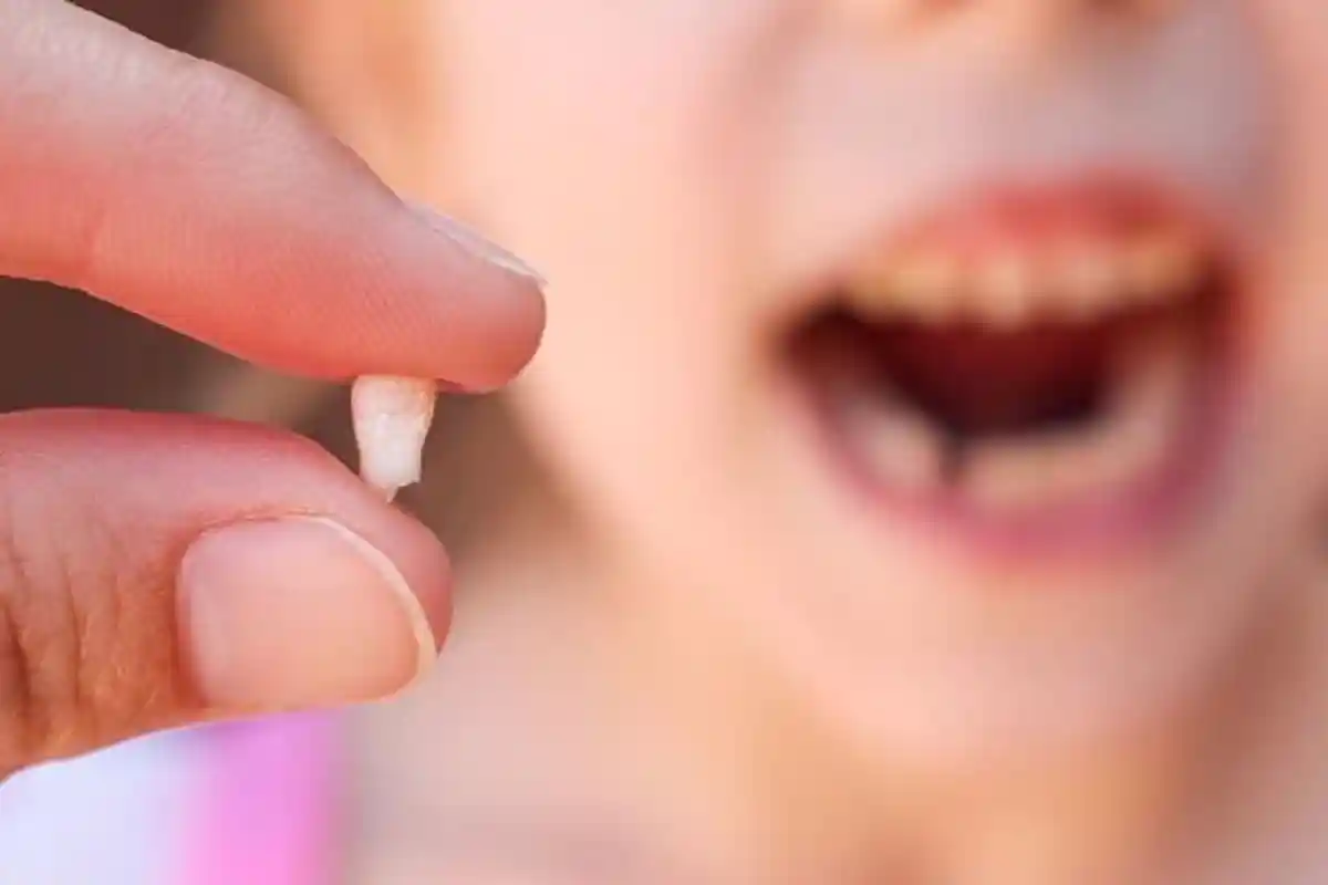 Arti Mimpi Gigi Copot, Harus Waspada, Bisa Jadi Pertanda Buruk untuk Anda, Begini Tafsirannya