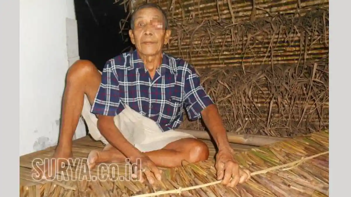 Penderita Daging Tumbuh di Mata Ini Pantang Menyerah, Terus Berjuang Demi Keluarga