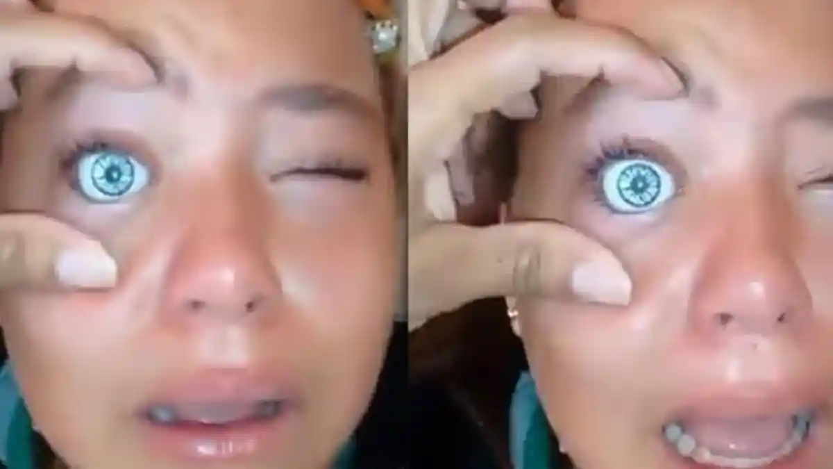 Gadis Ini Masukkan Mata Boneka ke Matanya demi Ingin Punya Mata Biru, Tapi Hasilnya Mengerikan