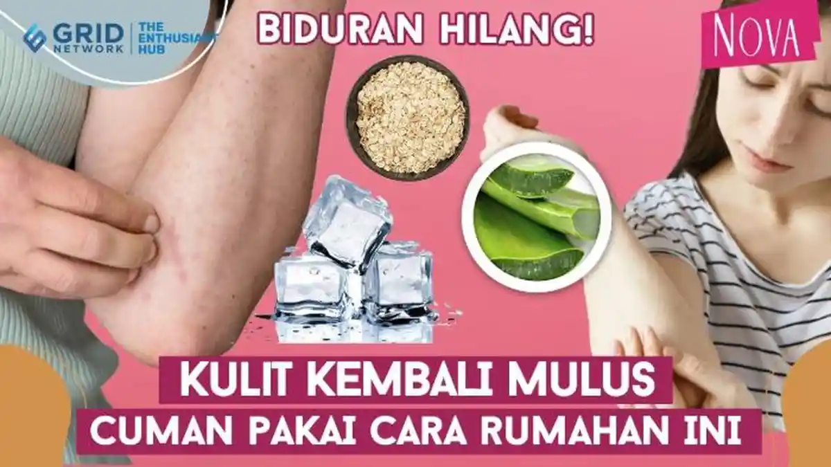 5 Tips Ampuh Atasi Biduran secara Alami Plus Doa Meminta Kesembuhan, Pulih Semalam Pakai Obat Ini!