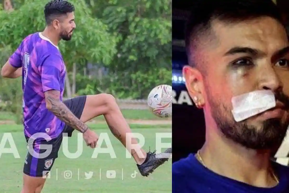 Sosok Julian Guevara yang Alami Insiden Horor saat Arema FC vs Dewa United, Mata Lebam & Gegar Otak