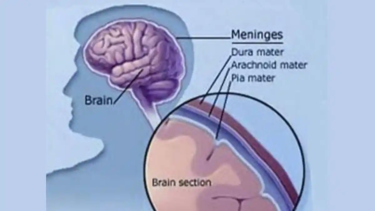 POPULER Gejala & Penyebab Utama Penyakit Meningitis, Pengobatan Tergantung pada Penyebabnya