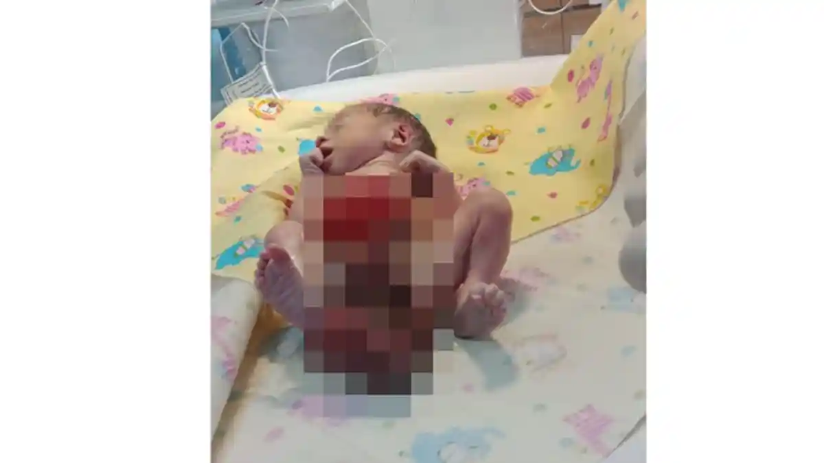 Gunawan Syahputra sudah Ikhlaskan Kepergian Bayi Arjun Adipati yang Terlahir tanpa Dinding Perut
