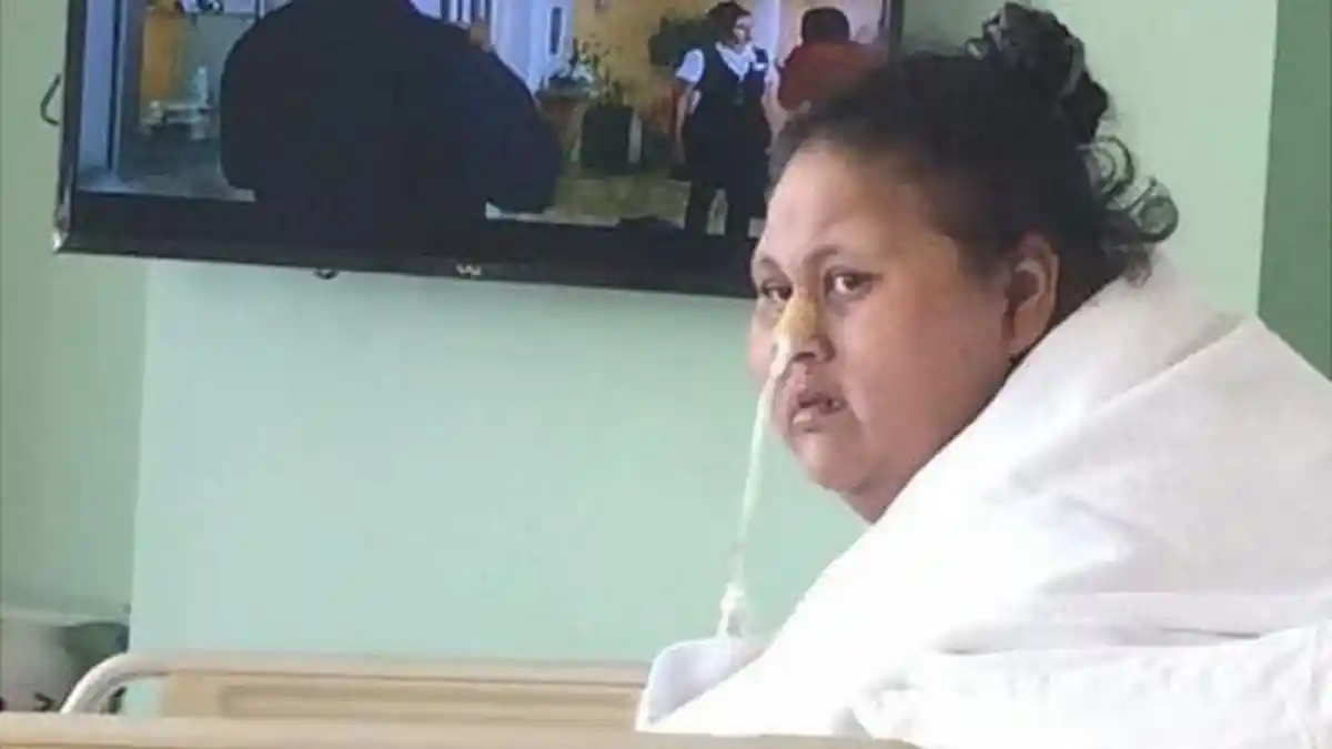 Usai Operasi Turunkan Berat Badan dari 500 Kilo Jadi 172 Kilo, Wanita Ini Disuruh Pulang