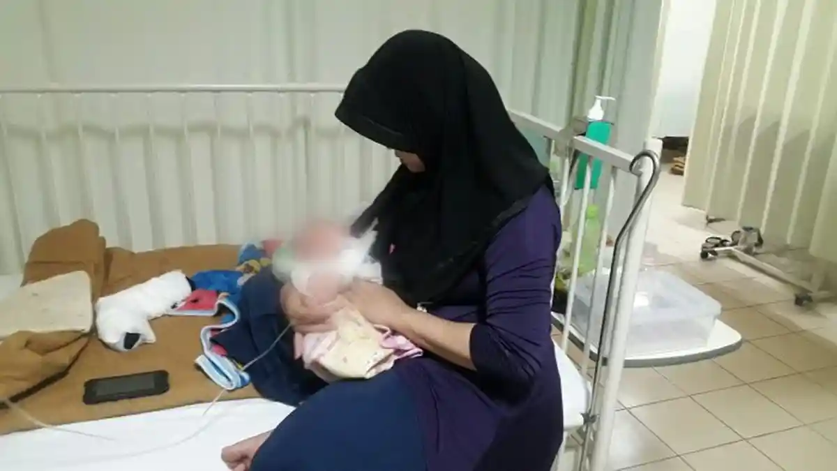 Operasi Bayi Malang yang Miliki Tonjolan di Kepala Tunggu Hasil Lab