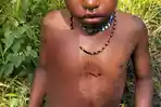 Bocah-Korban-Penembakan-di-Kabupaten-Puncak.jpg
