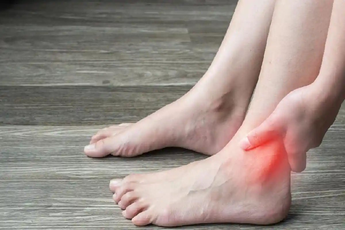 Asam Urat Kambuh, Bisakah Sembuh Sendiri?