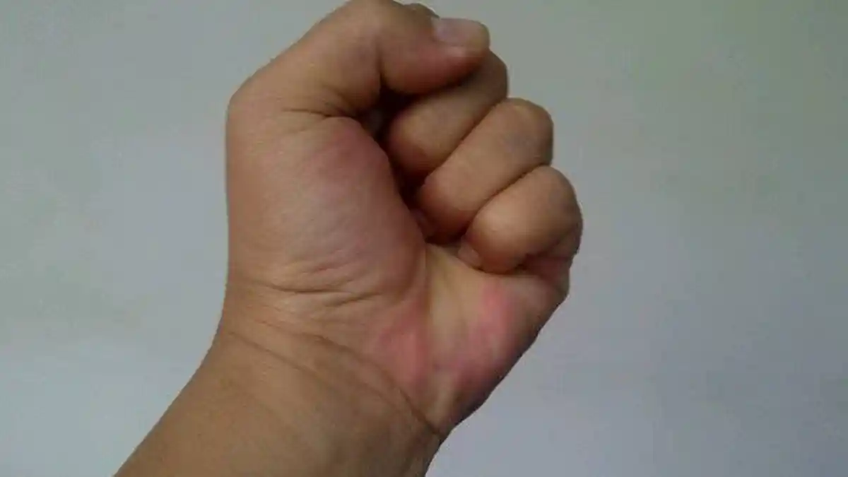 Tegur Suami  Bermain Judi, Istri Dianiaya hingga Babak Belur