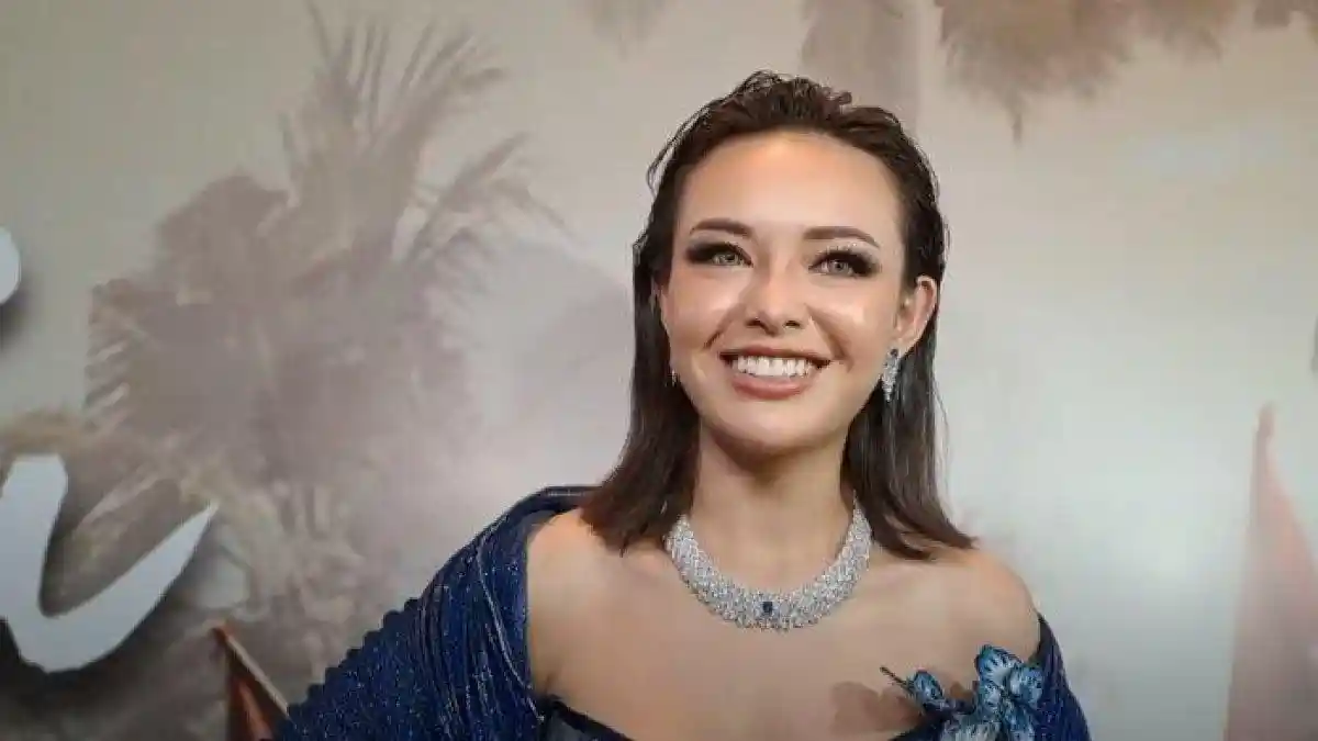 Wajah Amanda Manopo Berubah Jadi Lebih Tirus, Benarkah Operasi Plastik?