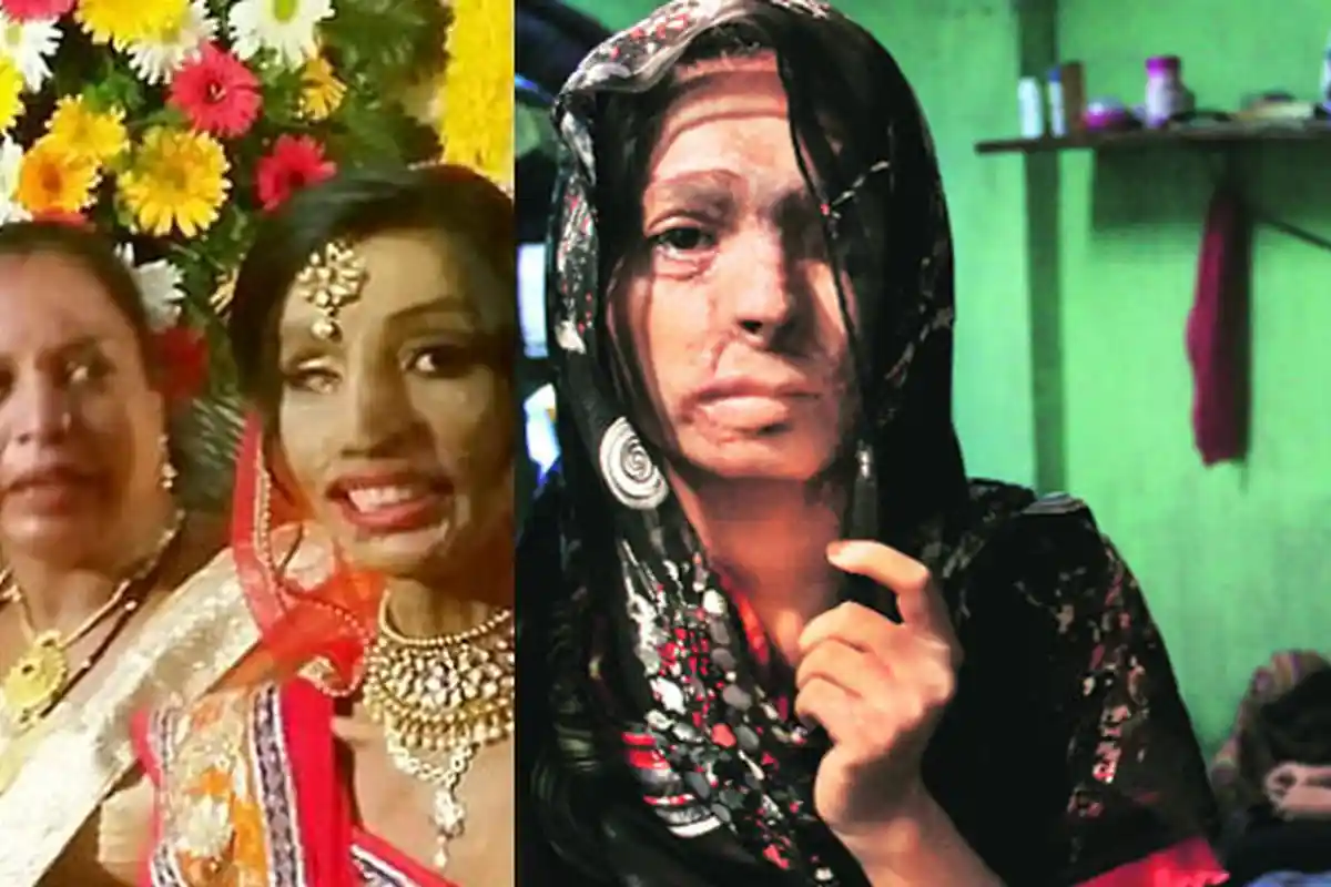 Putus Asa Wajahnya Tersiram Air Keras, Hidup Wanita Ini Malah Berubah Usai Salah Tekan Nomor Telepon