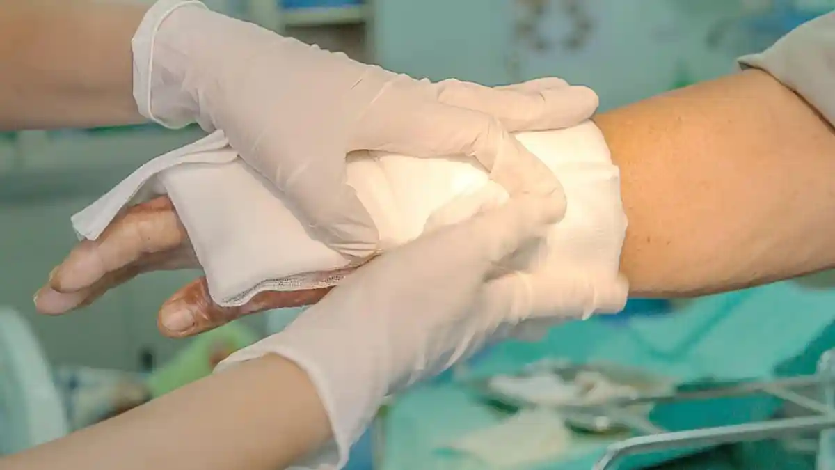 Ketahuan Merokok, Santri di Kudus Dihukum Celupkan Tangan ke Air Panas hingga Tangan Melepuh