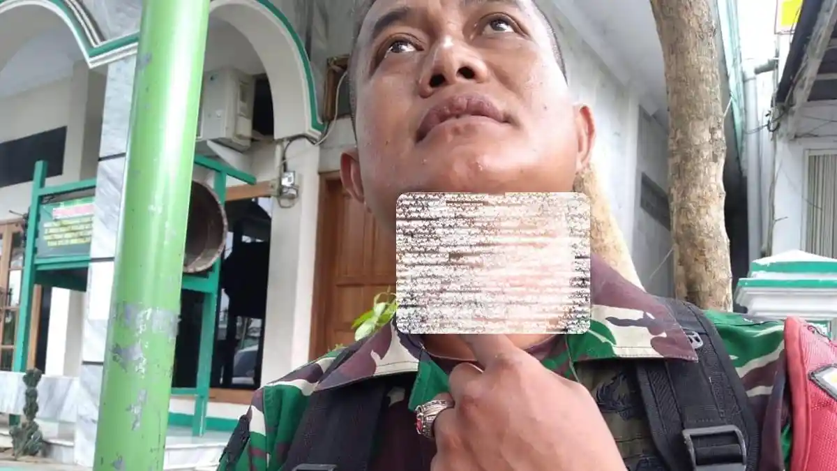 Leher Anggota TNI di Ciamis Terjerat Kabel Internet yang Melintang di Jalan, Alami Luka