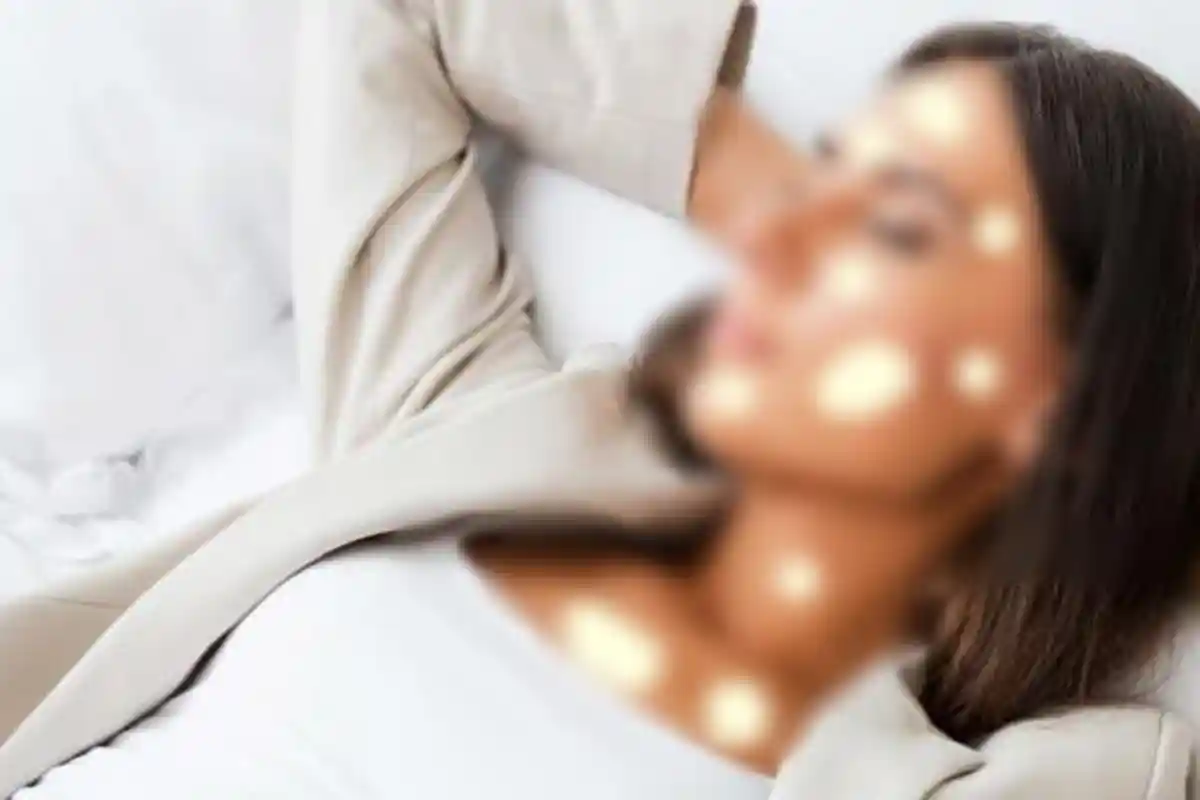 Kenali Jenis Vitiligo dan Perbedaan yang Terjadi Pada Orang Dewasa dan Anak-anak