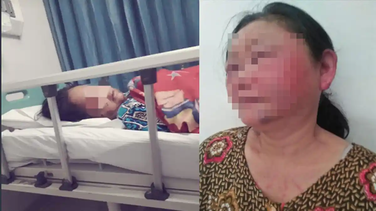 Suami yang Pukuli Istrinya Hingga Babak Belur di Bojonggede Ditangkap, Ini Kata Polisi