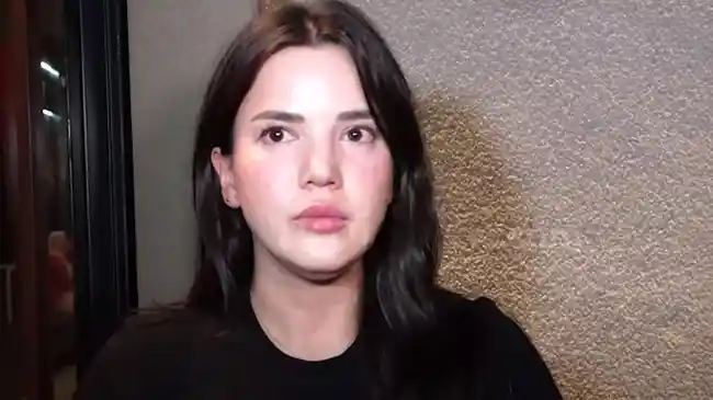 Alice Norin Ungkap Pengalaman saat Jalani Operasi Pengangkatan Kanker Sarkoma di Singapura
