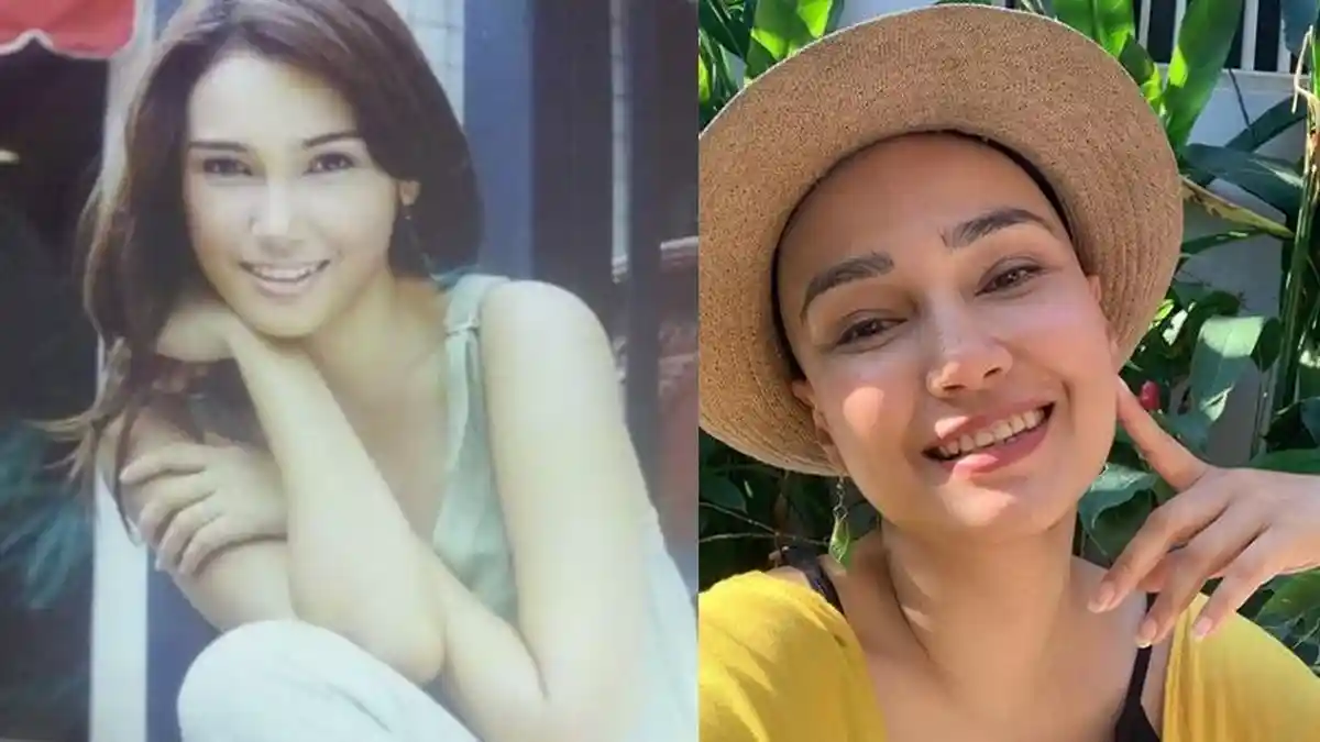 Feby Febiola Sembuh dari Kanker, Kepalanya Tak Botak Lagi karena Efek Kemoterapi