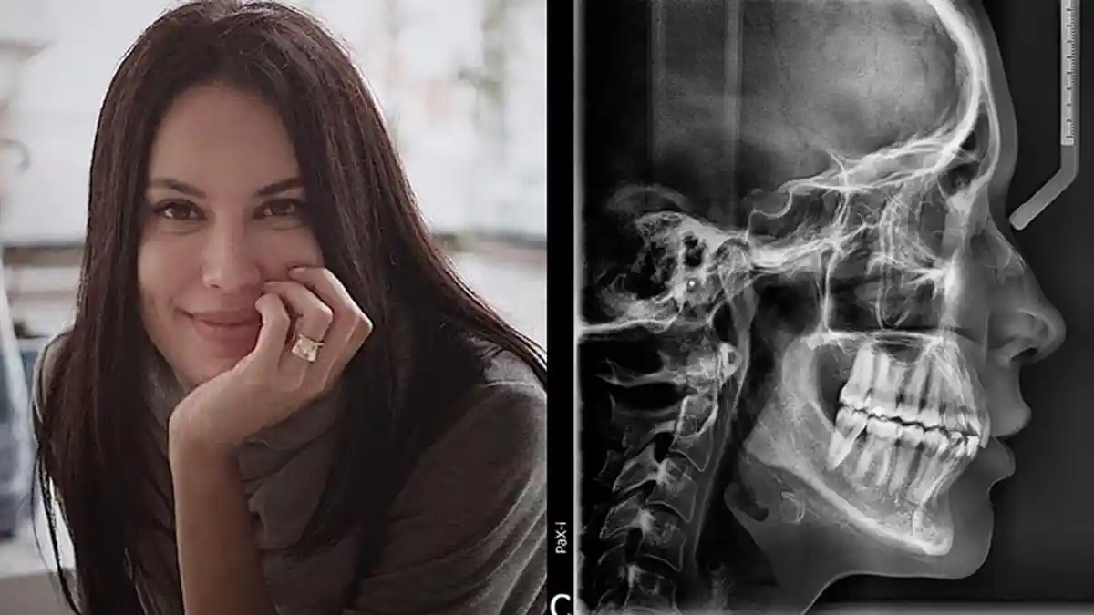 Viral Hasil Rontgen Sophia Latjuba Disebut Cantik Luar Dalam dan Definisi Cakep Sampai ke Tengkorak