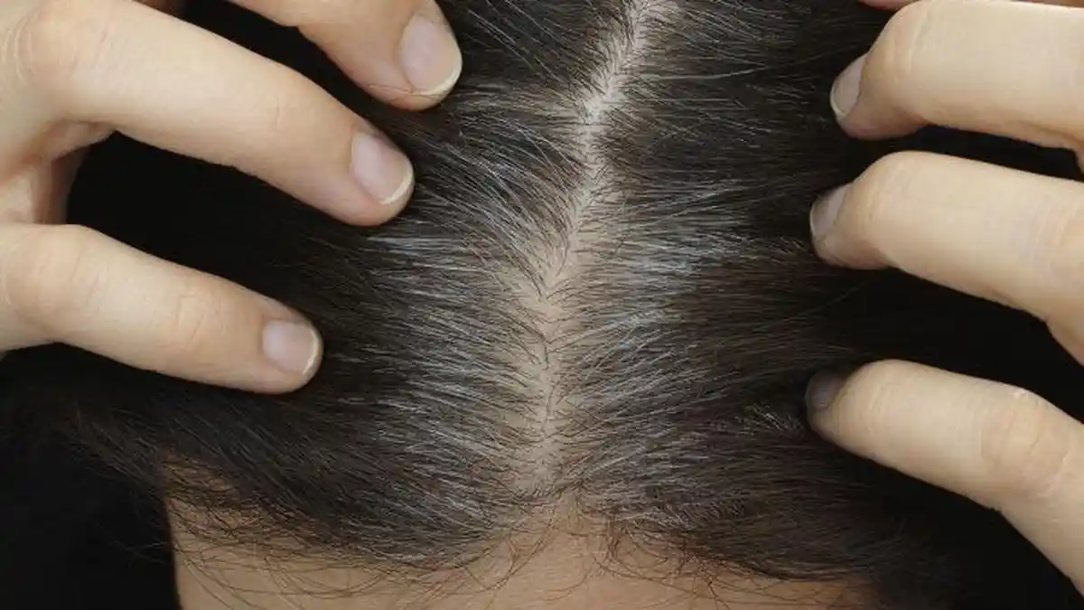 Benarkah Cabut Uban Malah Bikin Rambut Putih Makin Banyak? Simak Faktanya