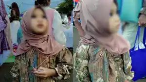 Arumi-balita-di-Bima-dengan-tangan-kanan-diamputasi-imbas-malpraktik.jpg