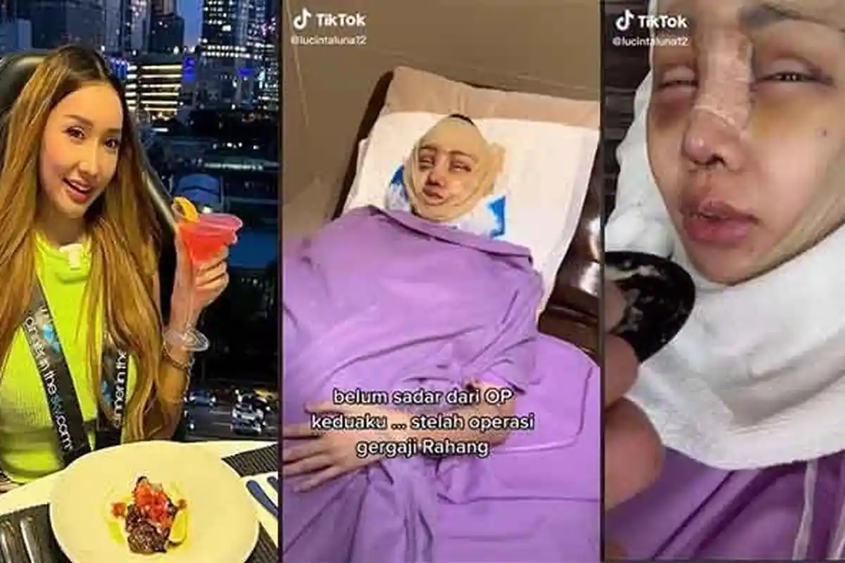 Lucinta Luna Klaim Suaranya Merdu seperti Syahrini Setelah Operasi