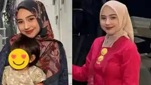 Ria-Ricis-lakukan-operasi-plastik.jpg