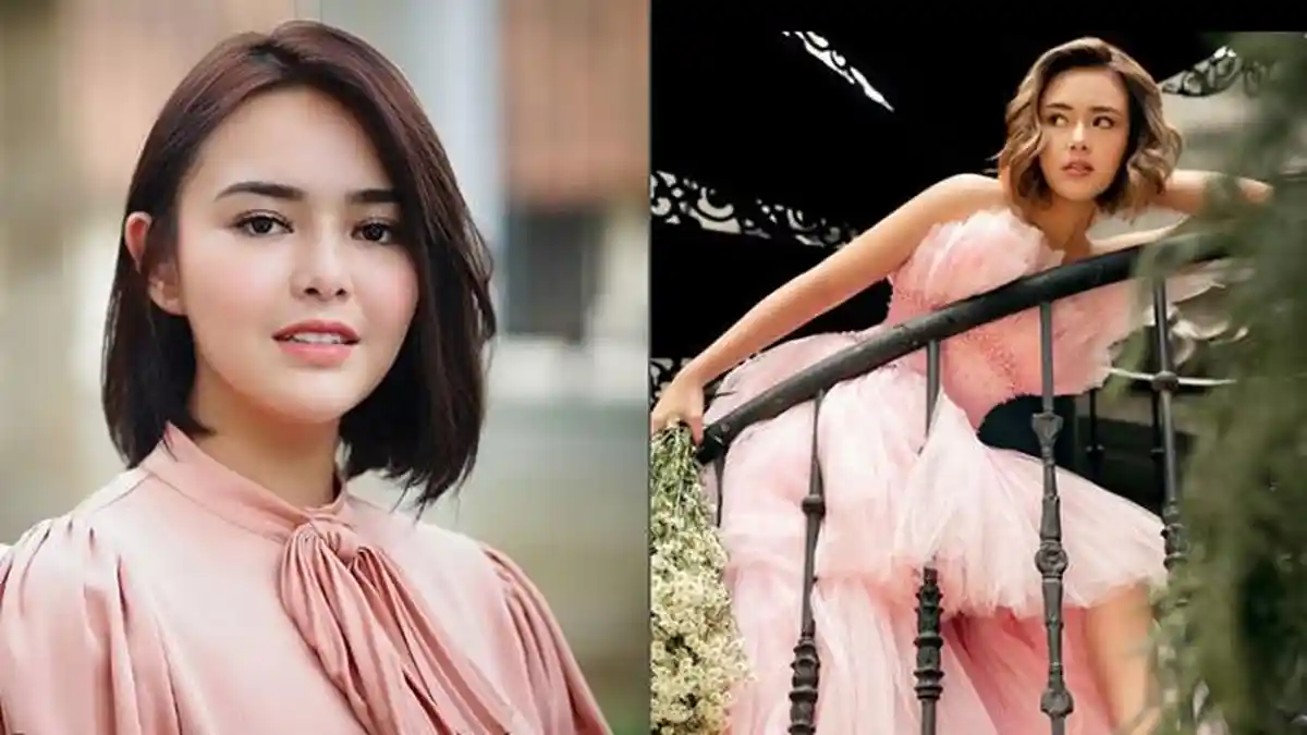 Amanda Manopo Alami Kecelakaan sampai Harus Lakukan X-Ray