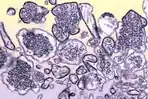 Ilustrasi-Virus-Nipah.jpg