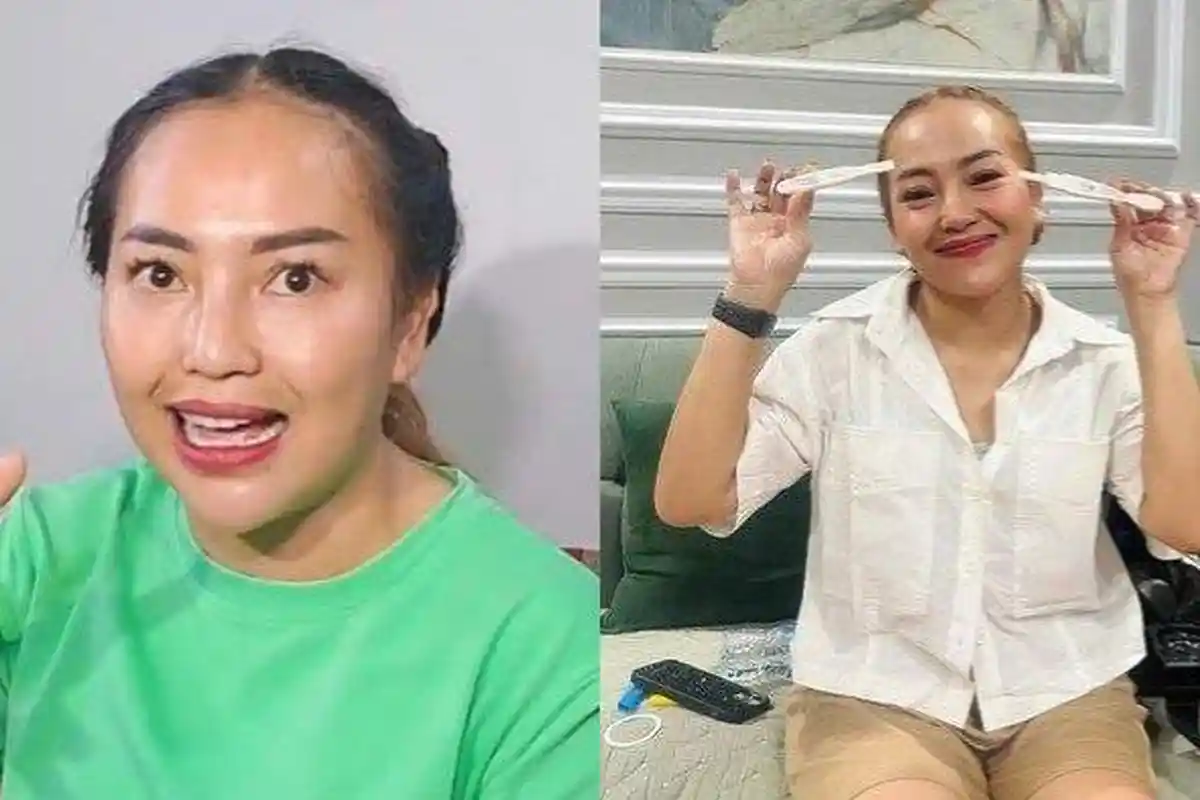 Mpok Alpa Ternyata Selama Ini Pakai Wig, Tutupi Rambut Rontok Gegara Kemoterapi