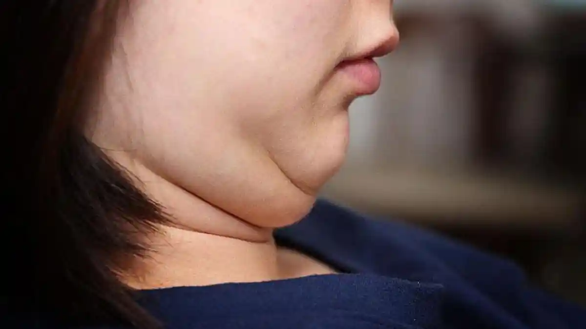 5 Trik Mudah Menyembunyikan Dagu Ganda 'Double Chin'