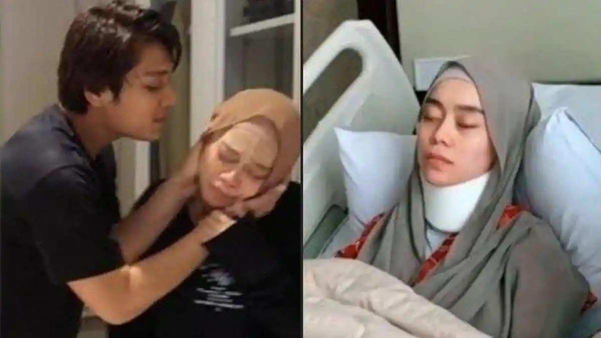 Lesti Kejora Ketakutan dan Trauma Setalah Alami KDRT dari Rizky Billar, Keberadaan Kini Terungkap