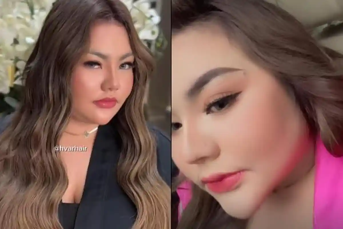 Ngebet Langsing, Lisa Mariana Konsul Dokter untuk Operasi Bariatrik: Biar Gak Dibully Netizen