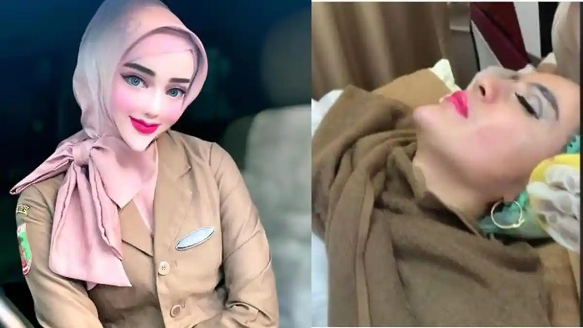 Wajah Asli Yuni Jasmine Tiktoker Viral Punya Dagu Super Lancip, Parasnya Saat Perawatan Bikin Syok