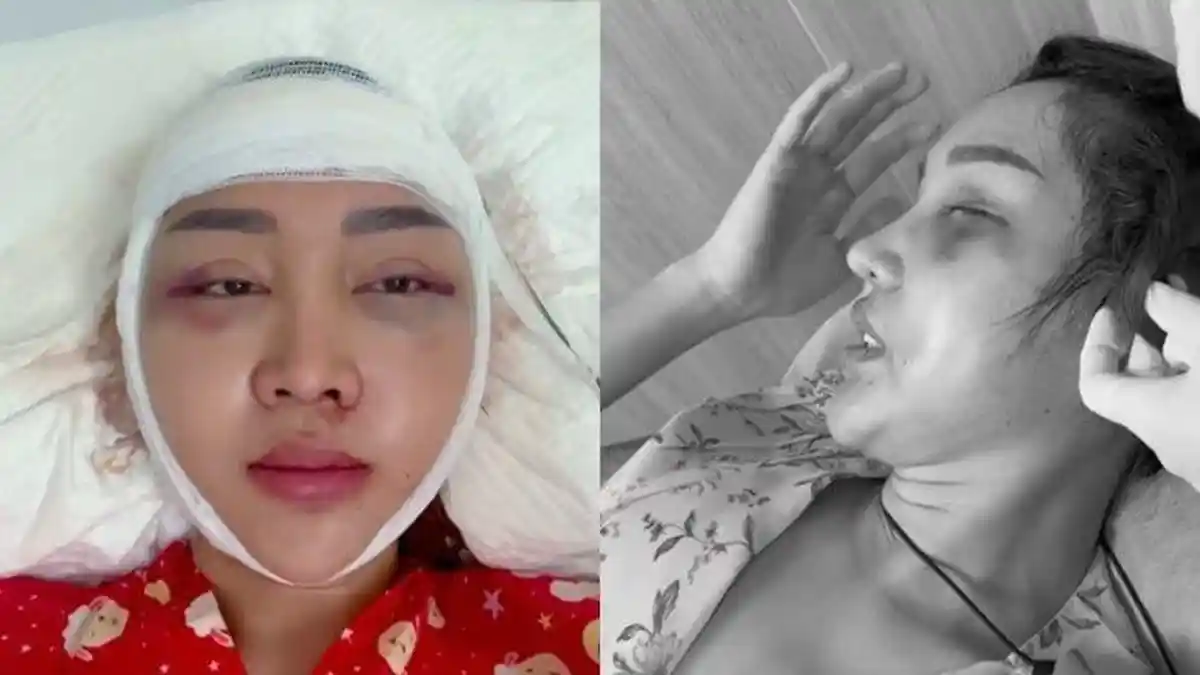 Selain Ingin Cantik, Inilah Alasan Lucinta Luna Terus Lakukan Operasi Plastik Meski Takut Mati