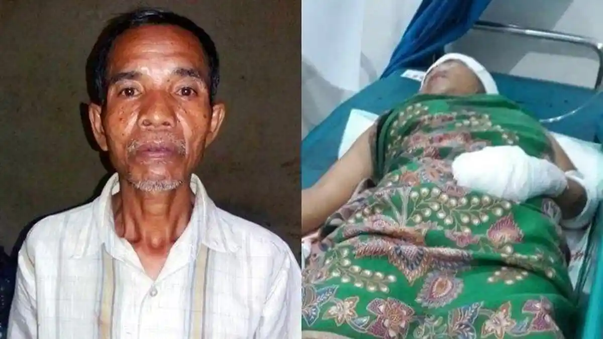 TRAGIS! Bermain dengan Tetangga, Kakek Terbakar Api Cemburu Bacok Istri Siri hingga Bersimbah Darah