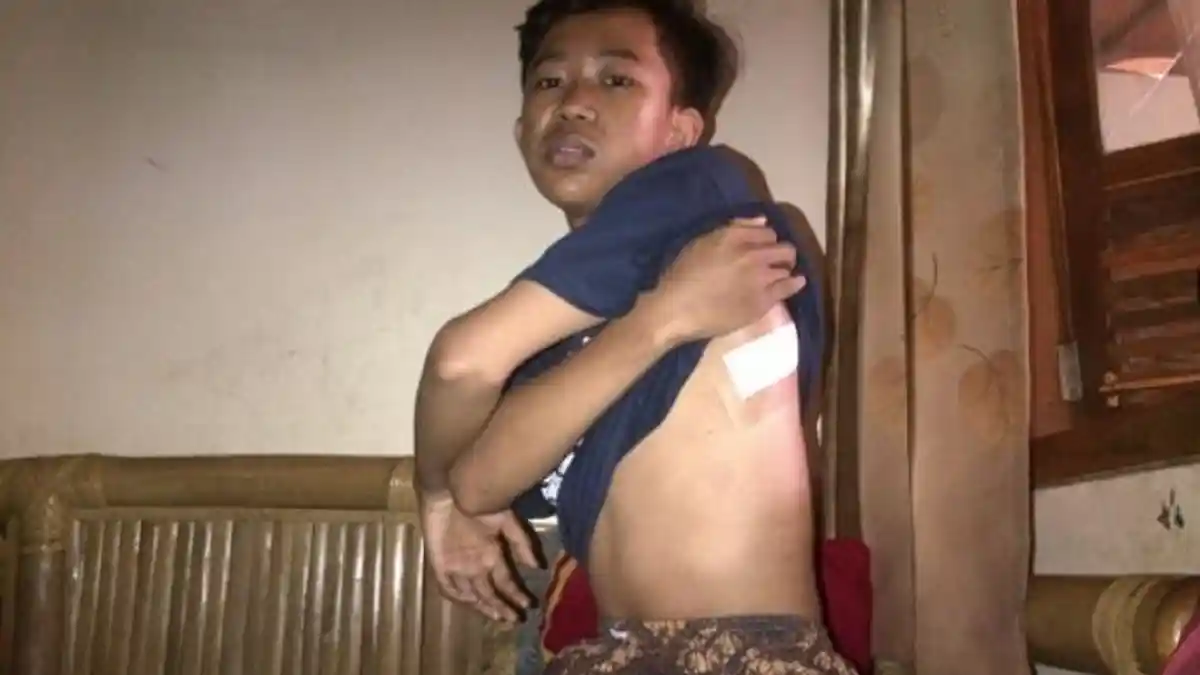 Asik Main HP Sambil Nunggu Istri Belanja, Gunawan Dibacok dari Belakang